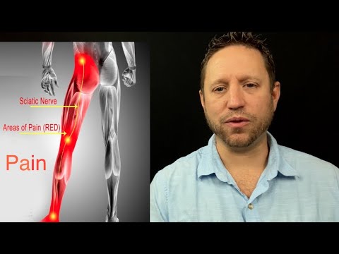 sciatica evansville stretch